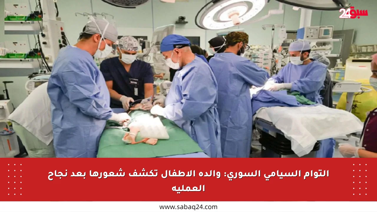 التوأم السيامي السوري: والدة الأطفال تكشف شعورها بعد نجاح العملية